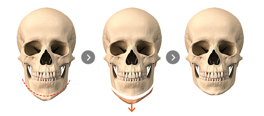 Around Rotation Cut